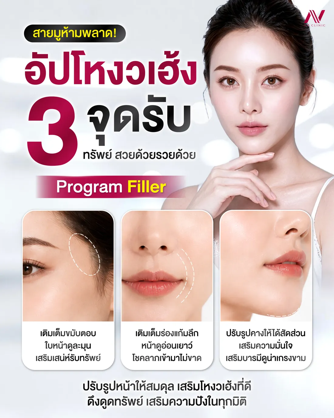 รีวิวก่อนหลัง ฟิลเลอร์หน้า/แก้ม/ขมับ NV Clinic
